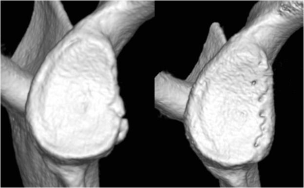 Journal of ISAKOS tweet media