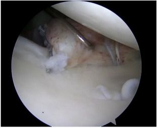 Journal of ISAKOS tweet media