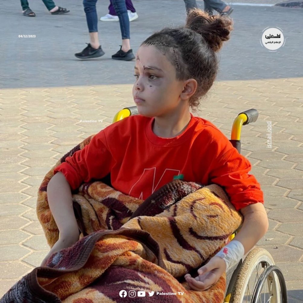 DrLoupis's tweet photo. Hi @Israel 🇮🇱

Was this beautiful little girl a “Hamas terrorist” since you destroyed her face and her legs? https://t.co/gHII7TjgW5