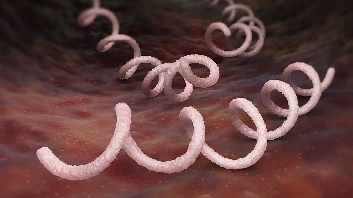 Syphilis cases are surging across U.S., but the National Coalition of STD Directors says there's a shortage of Bicillin L-A, a form of penicillin crucial to treating syphilis—and congenital syphilis—when newborns contract the bacteria from their mothers medicalxpress.com/news/2023-12-s…