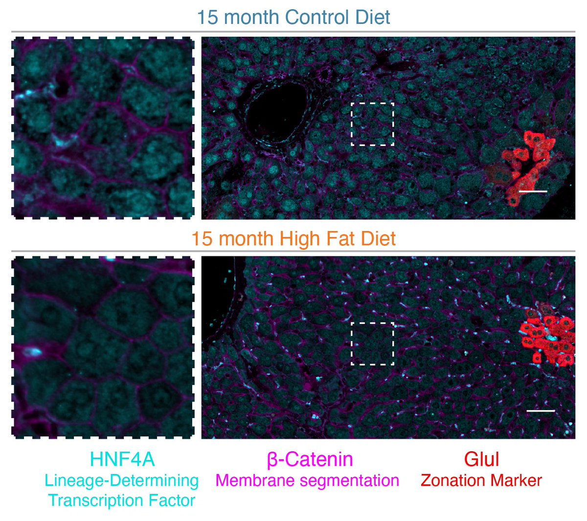 New preprint! In chronic stress, cells must balance their own survival with tissue-level roles. Prior work has emphasized stress-induced drivers of cell death, but what happens to surviving cells? How do they adapt, and how do their changes connect to long-term dysfunction? (1/n)