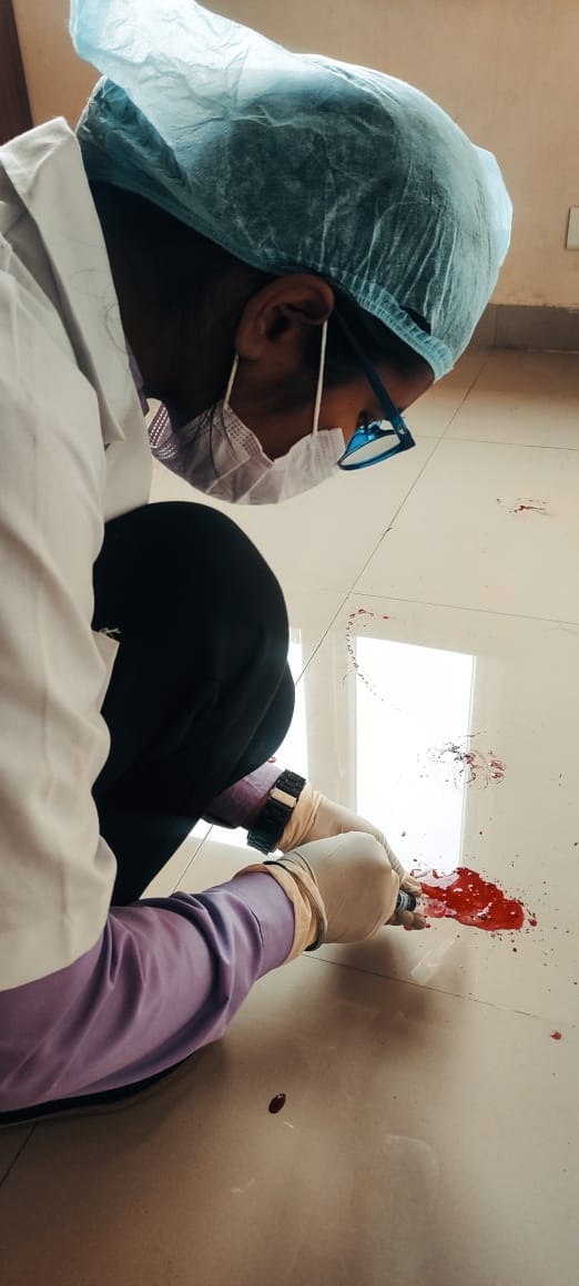 forensicUMU's tweet image. &quot;Precision in every drop: Collecting a blood sample from ground pooling using advanced syringe techniques.  Ensuring meticulous forensics to uncover vital details in investigations&quot;
#ForensicScience
 #BloodSampling #InvestigationInsights