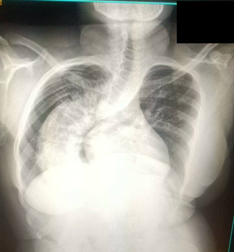 Keith Siau tweet media