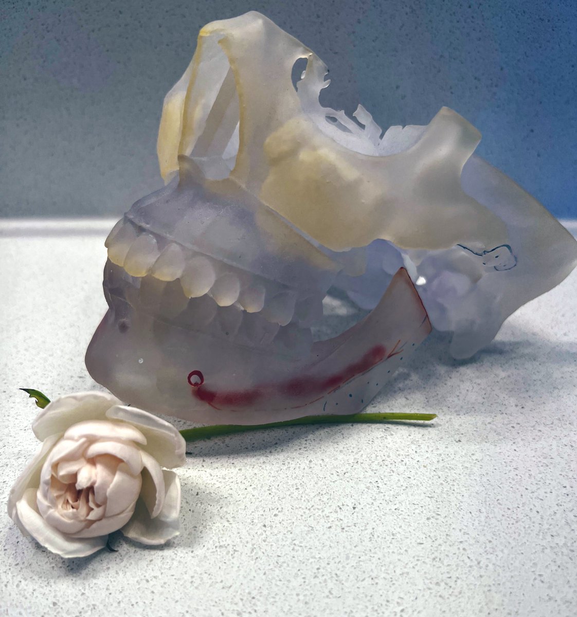 Thanks for choosing my work from <a href="/ApparitionLit/">Apparition Lit</a> as the poem of the day! Here’s the real-life medical model that inspired it (yes, that *is* my face)