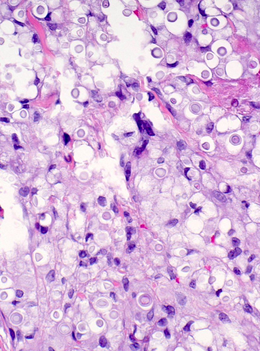 jaspamide tweet picture