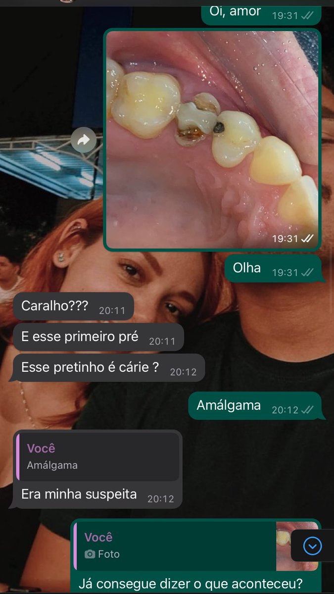 lanatomia's tweet photo. eu sou dentista, certo? e depois que me formei sempre me relacionei com dentistas pq acho mais tranquilo encontrar afinidade com gente da mesma área.. aí que meu namorado é contador e tudo pra ele é novidade. 

trago ibagens do diálogo sobre meu dia com o queridão: https://t.co/0uACwQKrKX