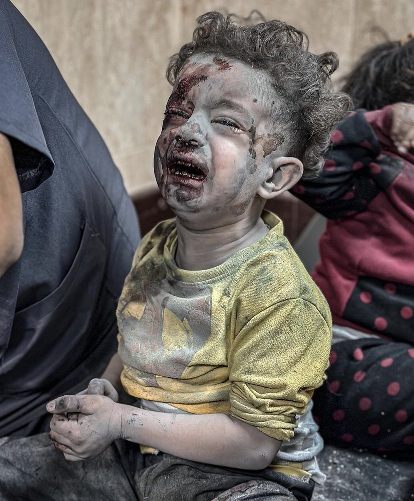 Bir zulme engel olamıyorsanız onu herkese duyurun.
 #GazzedeKatliamVar