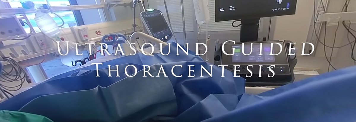 Alberta Sono (@ualberta_sono) on Twitter photo Up to some interesting things here @ Alberta Sono. Here is our latest creation: A VR training video for U/S-guided thora. Best seen w VR headset--but can also manipulate 2D video YouTube w cursor. Feedback welcome youtu.be/2oMRzYH0H2g?si…
<a href="/AIUMultrasound/">AIUM Ultrasound</a> <a href="/iceman_ex/">Segun Olusanya (He/Him) iceman_ex@critcare.social</a> <a href="/WINFOCUS/">WINFOCUS WORLD</a> Up to some interesting things here @ Alberta Sono. Here is our latest creation: A VR training video for U/S-guided thora. Best seen w VR headset--but can also manipulate 2D video YouTube w cursor. Feedback welcome youtu.be/2oMRzYH0H2g?si…
<a href="/AIUMultrasound/">AIUM Ultrasound</a> <a href="/iceman_ex/">Segun Olusanya (He/Him) iceman_ex@critcare.social</a> <a href="/WINFOCUS/">WINFOCUS WORLD</a>
