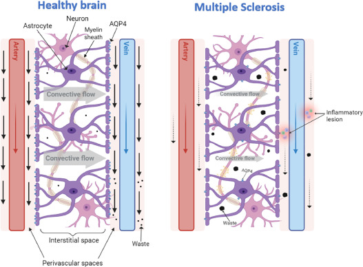A schematic of the interesting theory that multiple sclerosis is caused by disturbed glymphatic flow at the blood brain barrier.  Authors include @GavinGiovannoni  pubmed.ncbi.nlm.nih.gov/38039696/
