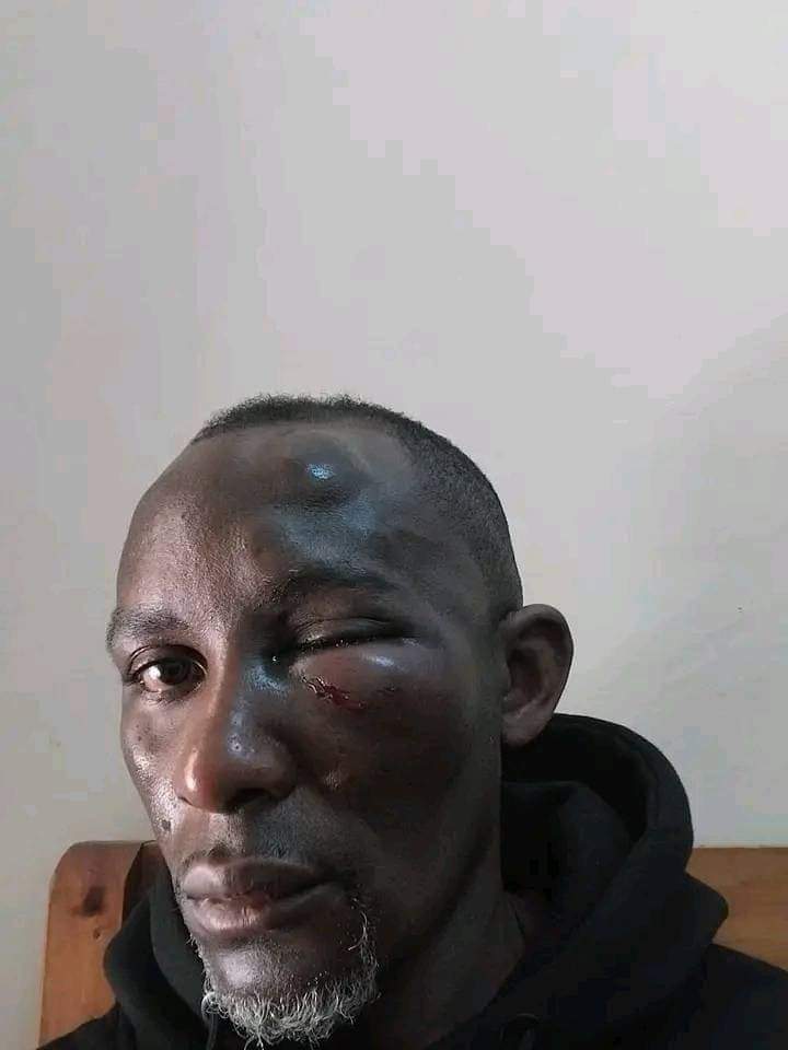 Copskenya's tweet photo. THIS is Harold, the manager of 305 Gardens (Restaurant) on James Gichuru, Nairobi. His boss has not paid him for 2 months. 

He questioned the boss about the money. The boss pulled out a gun and hit him on the face with the butt, then boxed him. Harold reported at Muthangari Police Station. The cops went and "temporarily" disarmed the boss.

The manager then went to hospital and back at the station but his case was top marinated.

As for the cops who HAD disarmed the boss, he has just left them at the Restaurant eating ribs and downing with expensive drinks.

This man has a family. His children and wife would want their father dignified with some justice. Atleast this is visible. Or you still want to hear the version of the boss? Assault causing grevious harm. The sentence is maximum 5 years.

Before then, get this police station boss out of this city. Kazi ya Nairobi imemueza.
@EACCKenya @DCI_Kenya @NPSOfficial_KE @KindikiKithure @IG_NPS @Fchurii

#CopsKenya