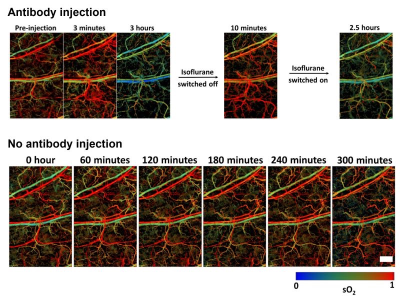 khadriaa's tweet photo. Over 100 monoclonal antibodies have been approved for therapeutic use. We report an unusual serendipitous observation where IgG4 monoclonal antibodies significantly reduce blood oxygen in anesthetized mice. We do not know the reason behind it
https://t.co/OQYaIuDLLp @Caltech https://t.co/FbbMulCIn7