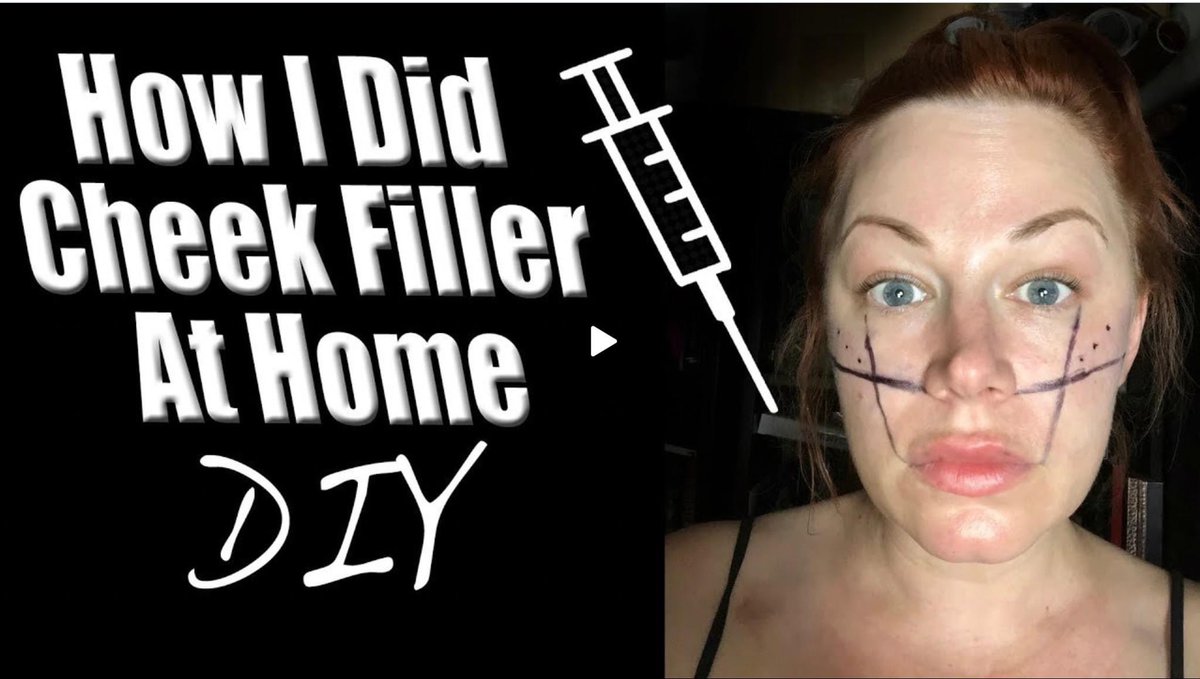 Wannabebeautyjc's tweet photo. Resharing an old video featuring my first time getting cheek fuller! Watch now https://t.co/59GEs36lUJ shout out if you remember the dark apartment days sbd my red hair phase lol #cheekfiller #cheekfillers #cheekfillerbeforeandafter https://t.co/l1JsYKBsfE