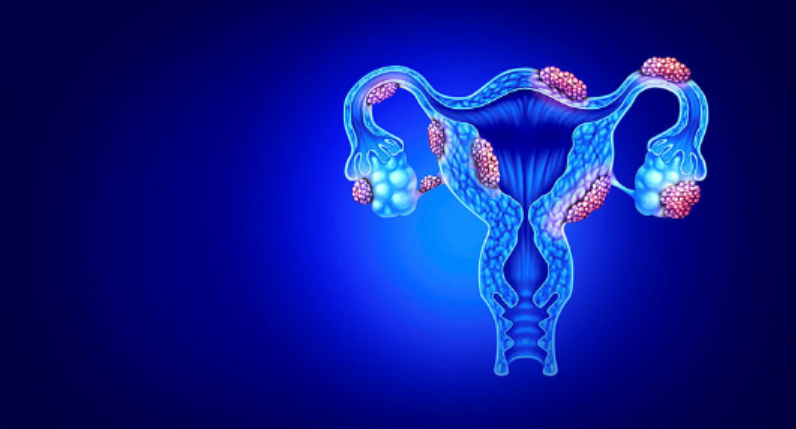 BMCMedicine's tweet photo. New Research paper from @IsabelleMcGr et al.: Polygenic risk score phenome-wide association study reveals an association between #endometriosis and testosterone: https://t.co/ZBeBkn4eJH https://t.co/HRuoux2bww