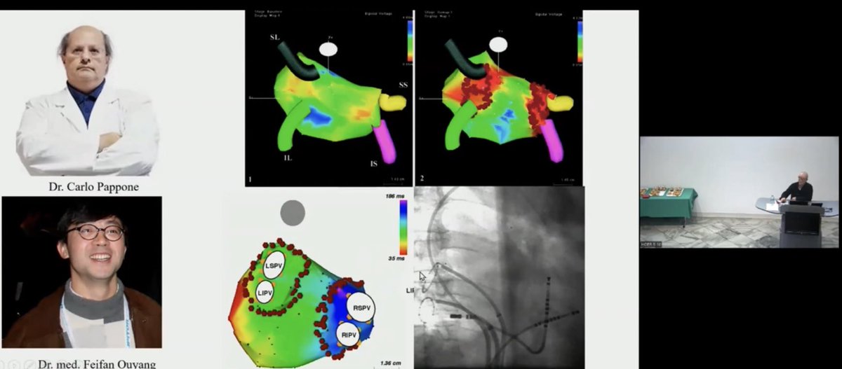 Excellent summary of the history of catheter ablation by Feifan Ouyang <a href="/DrFeifan/">Dr. Med. Feifan Ouyang</a>!

Learning from the experts of #Electrophysiology 

👉 on demand: youtu.be/akOWWuwCanI 

Hosted by <a href="/ASaguner/">Ardan M. Saguner, MD</a> <a href="/CardioZurich/">Cardiology USZ</a> <a href="/Unispital_USZ/">Unispital_USZ</a> 

<a href="/YoungDgk/">Young DGK</a> <a href="/YoungDZHK/">Young-DZHK</a> <a href="/DGK_org/">Deutsche Gesellschaft für Kardiologie</a> <a href="/AGEP_DGK/">AGEP</a>