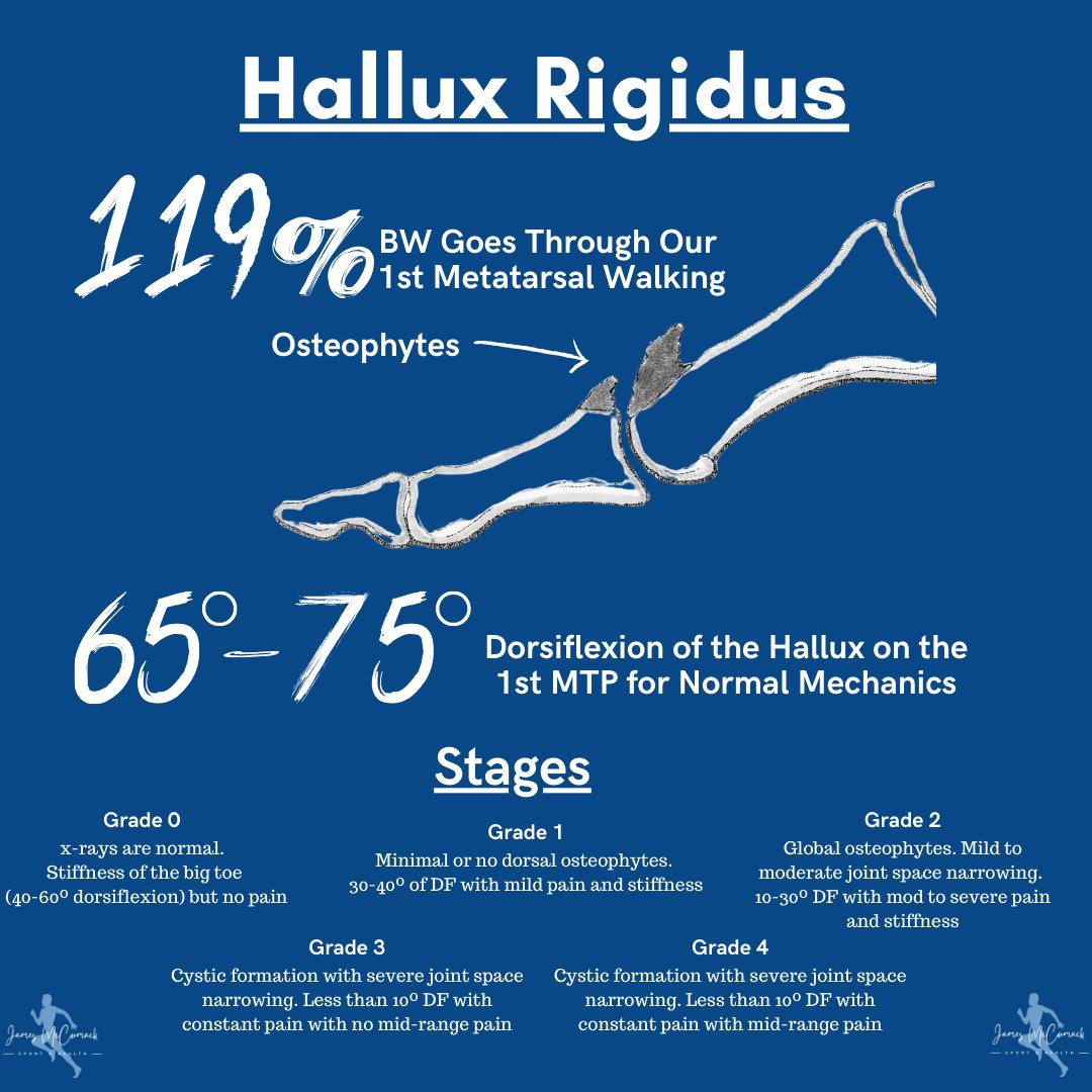 For normal mechanics for the big toe, 65-75º of dorsiflexion of the hallux on the 1st MTP is required. 

During this process, the 1st ray is required to plantarflex through contraction of the Peroneus Longus by pulling on a stable longitudinal arch of the foot. 

Soft tissue