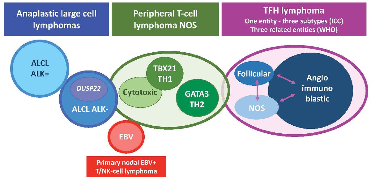 Haematologica's tweet photo. #PeripheralT-CellLymphoma: read the new review about the pathology and biology of nodal-based #PTCL entities, with an emphasis on recent findings and underlying oncogenic mechanisms.
https://t.co/HhSdQnitlc https://t.co/64V5KLChTd