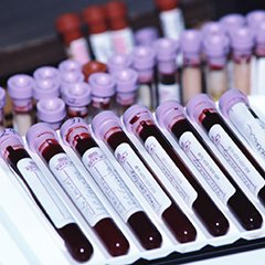 ISSalute_it's tweet photo. L’esame dell'azotemia serve per misurare la concentrazione nel sangue di azoto ed è consigliato dal medico per poter valutare il corretto funzionamento dei reni 👉https://t.co/nK2O0KjeRj #azotemia #esamidelsangue https://t.co/yLEdrvyk47