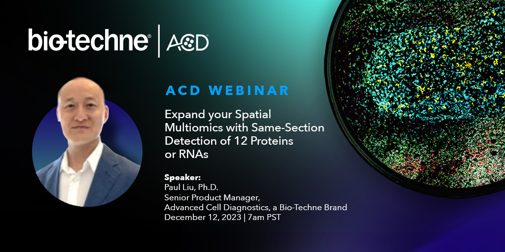 bt_spatial's tweet photo. Introducing a new #multiomic service offering enabling detection of 12 proteins or RNAs and immediate interrogation of the tumor microenvironment from ACD’s Professional Assay Services. #AdvancingYourRNAscopeISH #SpatialMultiomic
Dec 12, 7am PST – Register https://t.co/62spqHi3M0 https://t.co/zpjdonsfc4