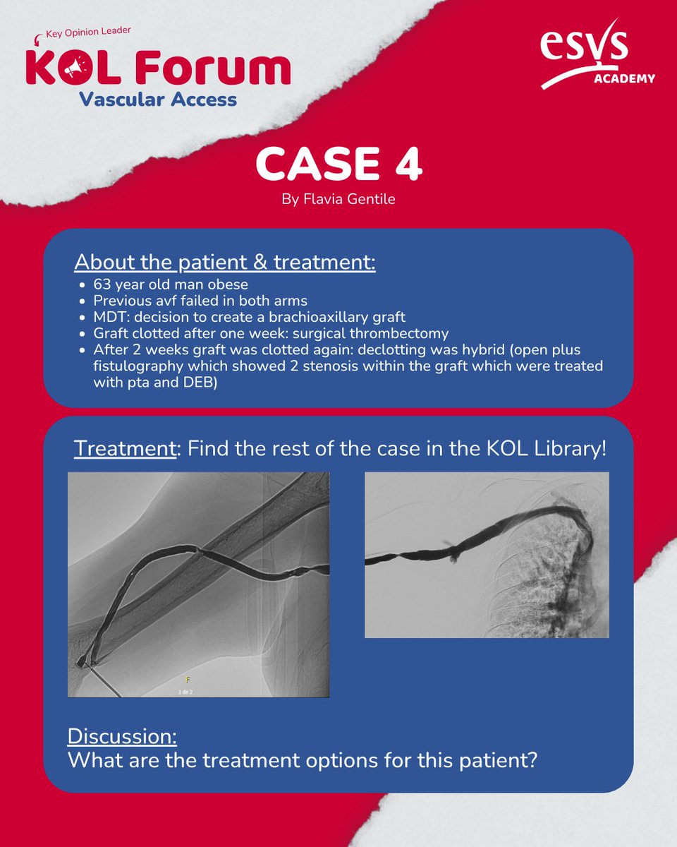 What would you have done? Our Key Opinion Leader Forum on #VascularAccess. These were the cases we discussed during our time together! Check out the full case presentations on our website and reply to this tweet to let us know what you think👇 esvs.org/events/kol-for… @drflaviag