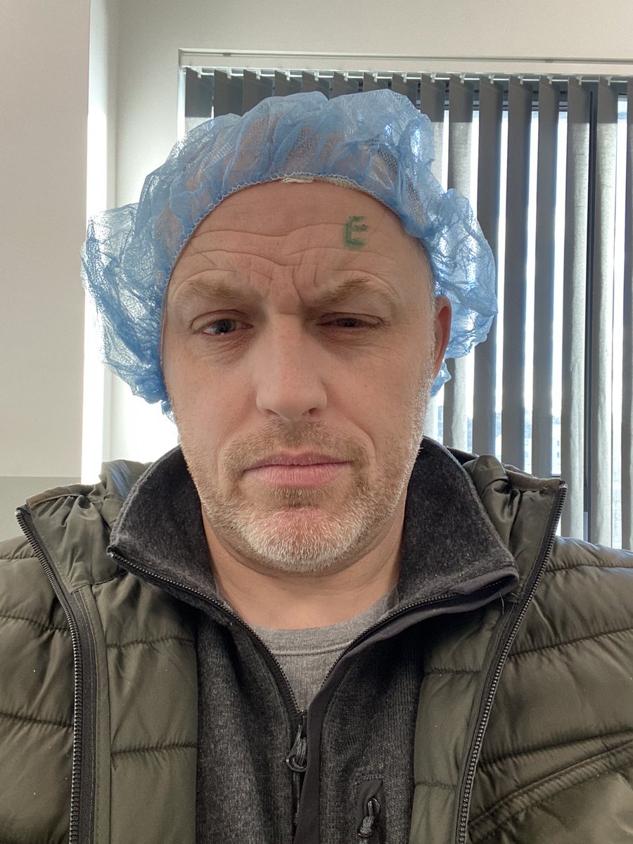 NiceGuyAidey's tweet image. Eylea time again 🥴 thanks @NHS for excellent care as usual #Eylea