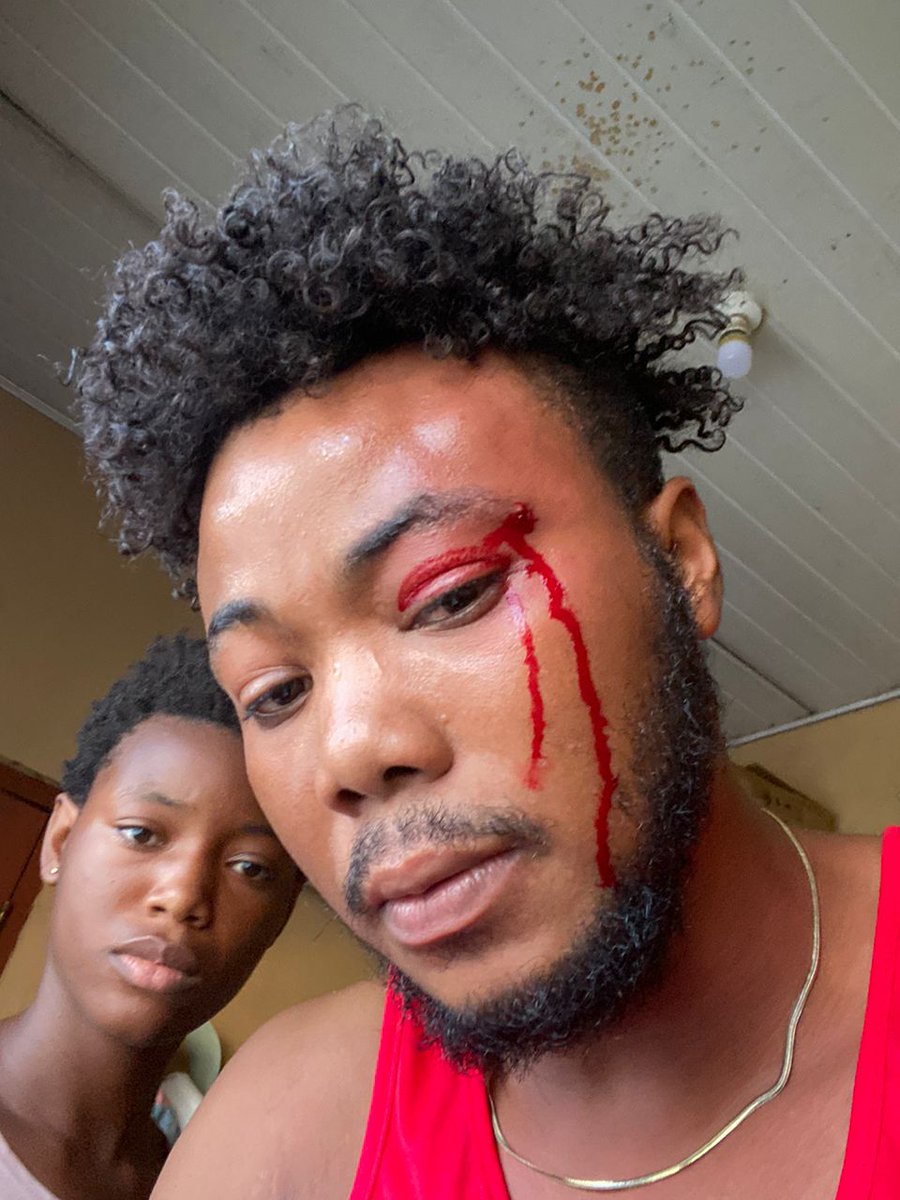 MehLilith's tweet photo. From paying for all the costs of these attacks.THE POLICE IS NOT HELPING US ,NOBODY IS , PEOPLE ARE LITERALLY STANDING AROUND AND WATCHING US GET ATTACKED.PLEASE SPREAD THIS THREAD,CLICK THE LINK ON THE GOFUNDME. If we die tomorrow I want the world to know we didn't go easy . https://t.co/PAkjHbkGi8