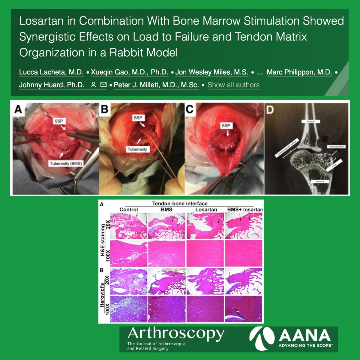 Losartan in Combination With Bone Marrow Stimulation Showed Synergistic Effects on Load to Failure and Tendon Matrix Organization in a Rabbit Model @MillettMD ow.ly/nkO850QeRCn