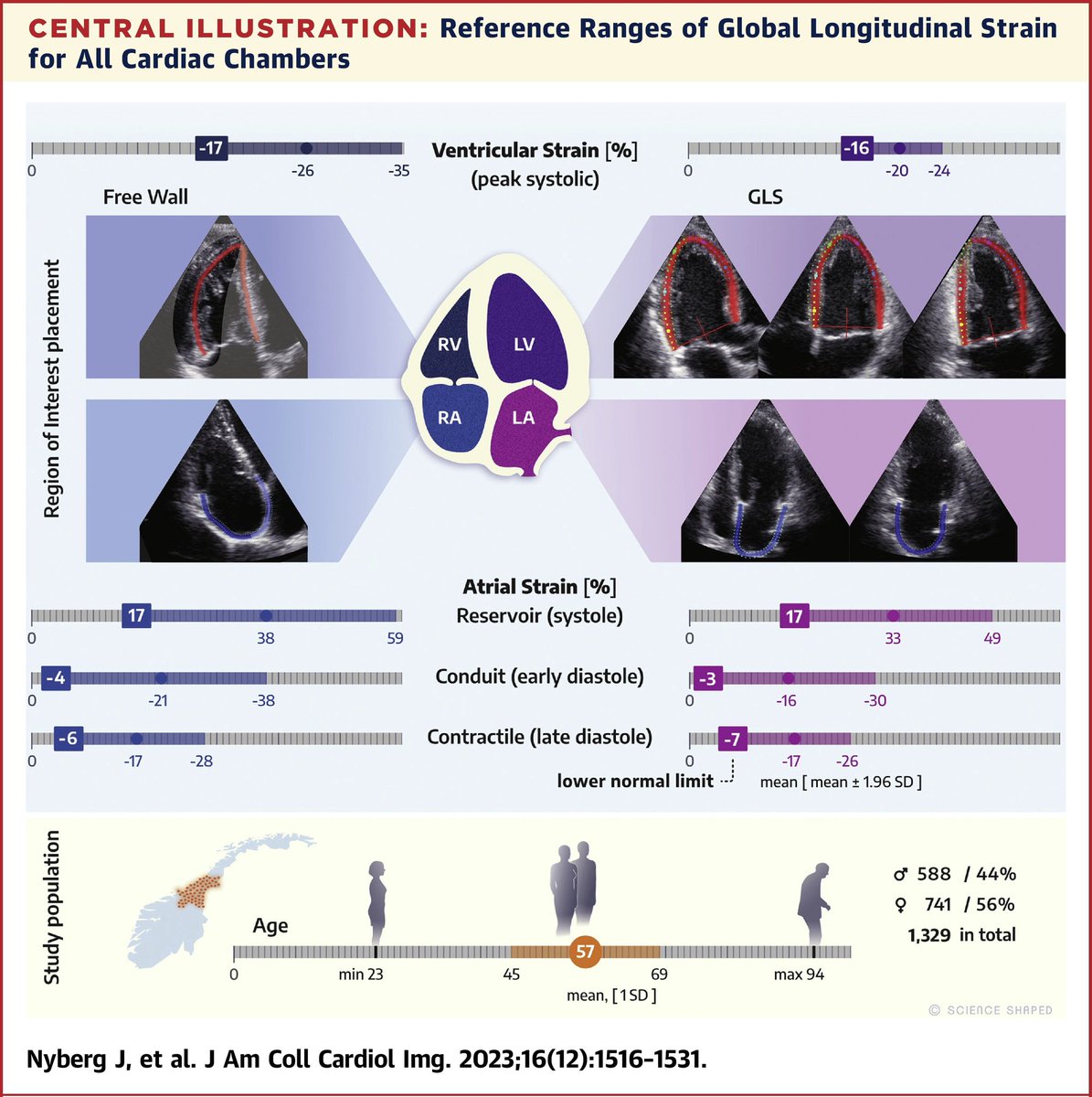 Echocardiographic Reference Ranges of Global Longitudinal Strain for All Cardiac Chambers Using Guideline-Directed Dedicated Views

sciencedirect.com/science/articl…
#echofirst #cardiology #cardiotwitter #heartfailureclin #echofirst #CardioTwitter #cardiology #JACCIMG #CardioEd #Cardiology