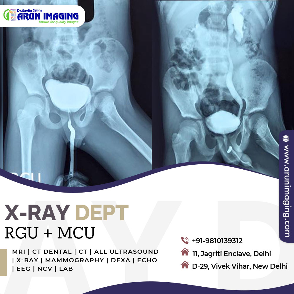 👁️ Exploring the unseen realms of health at the X-RAY DEPT, where technology meets precision! -@ArunImaging 𝐂𝐚𝐥𝐥 𝐔𝐬: +91-9810139312 𝐁𝐨𝐨𝐤 𝐎𝐧𝐥𝐢𝐧𝐞 𝐀𝐩𝐩𝐨𝐢𝐧𝐭𝐦𝐞𝐧𝐭: arunimaging.com #ArunImaging #HealthTechMagic #XRayExploration #MedicalMarvels