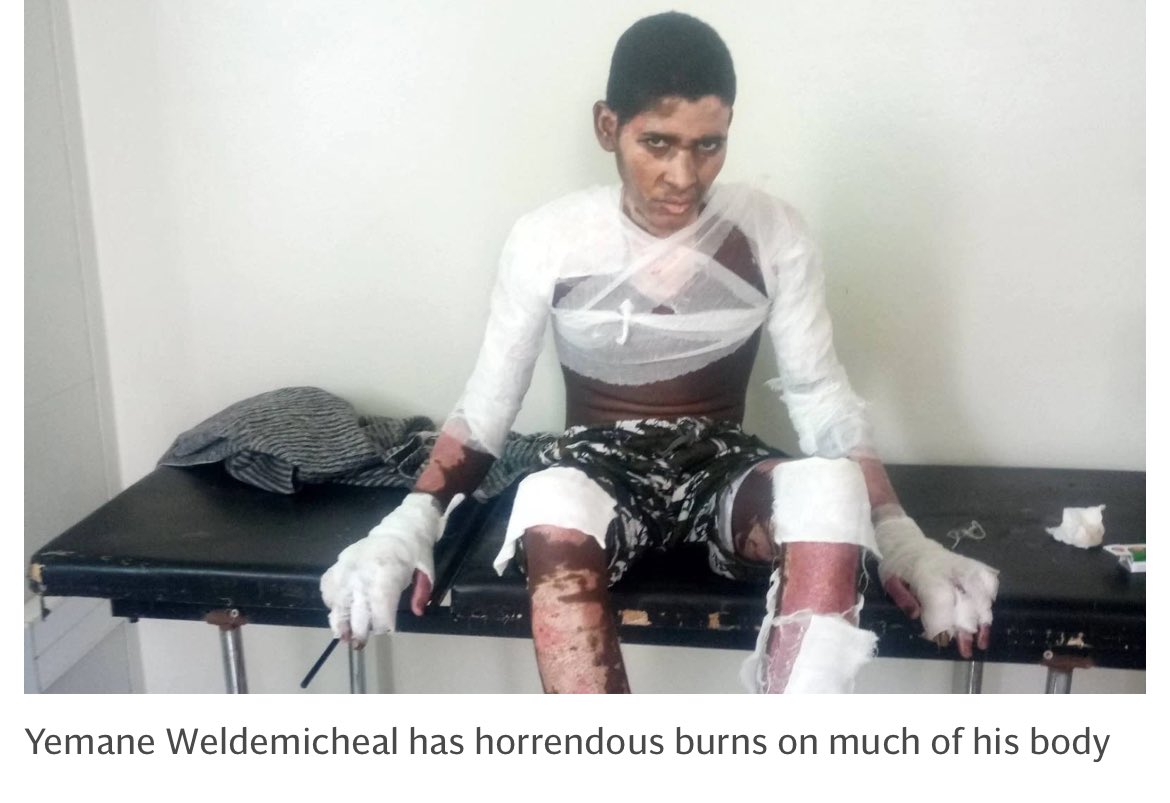 HeranTigray's tweet photo. Here are some of the pictures of victims of chemical warfare that were used by Eritrea 🇪🇷 and Ethiopia 🇪🇹 impacting children
Kisanet Gebremichael
Yemane Weldemichael
Eleni Yibarek
Nikisat Gebremichael
Tigrayans asked for the extension of ICHREE, the world refused. #TigrayGenocide https://t.co/oD79FtudKv