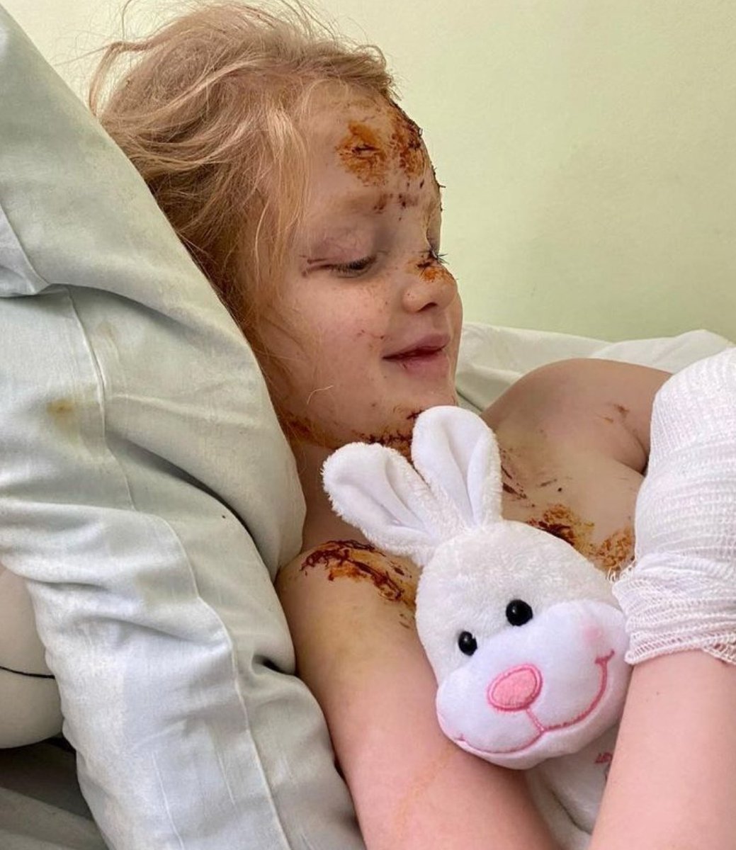 Lyla_lilas's tweet photo. Alisa 5 years old, was wounded by russian shelling in Kherson...
Not because Ukrainians don't show the children wounded everyday that it mean there is nothing. https://t.co/3Hx9hMSYOG