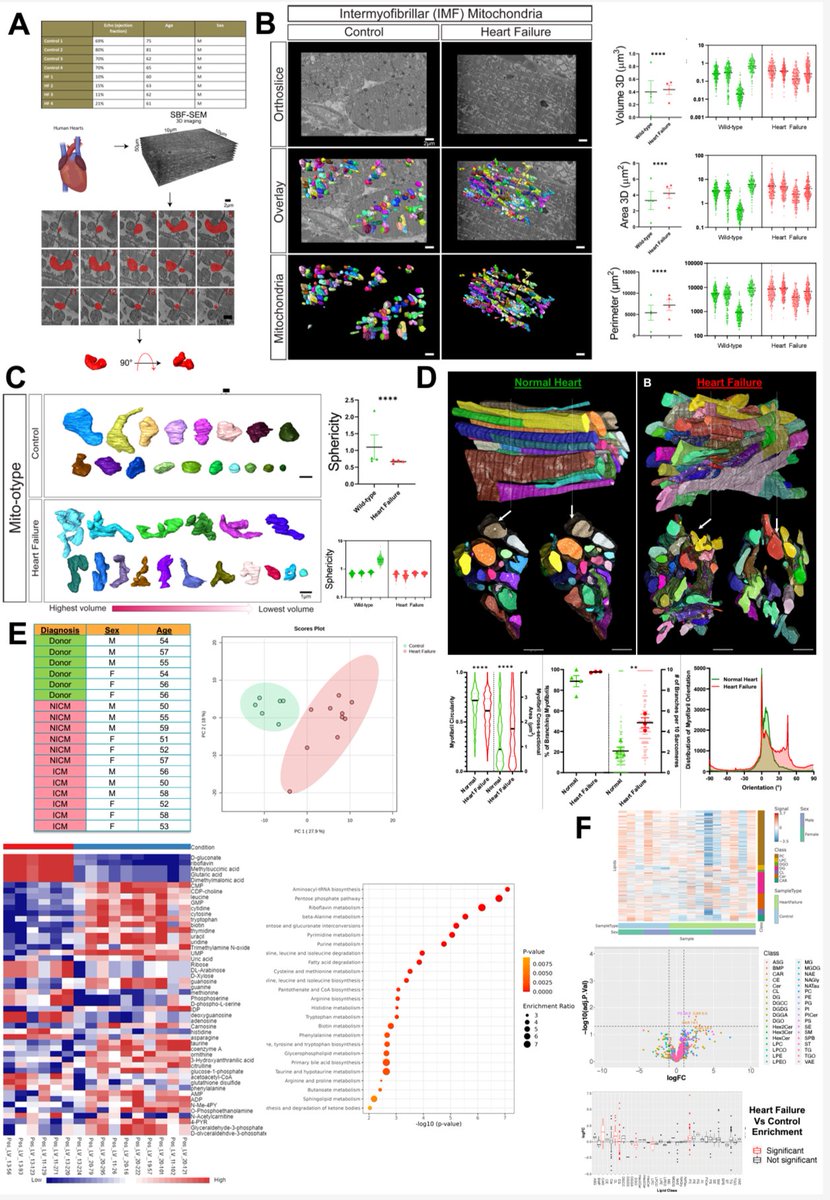 Antentor Othrell Hinton, Jr PhD (A.J. Hinton) (@phdgprotein86) on Twitter photo Human Heart Failure Alters Mitochondria and Fiber 3D Structure Triggering Metabolic Shifts. Thank you so much to my collaborators!
Thank you <a href="/brianglancylab/">Brian Glancy</a> for being co-senior & thank you <a href="/ZerVue/">Zer Vue</a> and <a href="/peterajayi_/">Peter Ajayi</a> for your amazing co-first author work! biorxiv.org/cgi/content/sh… Human Heart Failure Alters Mitochondria and Fiber 3D Structure Triggering Metabolic Shifts. Thank you so much to my collaborators!
Thank you <a href="/brianglancylab/">Brian Glancy</a> for being co-senior & thank you <a href="/ZerVue/">Zer Vue</a> and <a href="/peterajayi_/">Peter Ajayi</a> for your amazing co-first author work! biorxiv.org/cgi/content/sh…