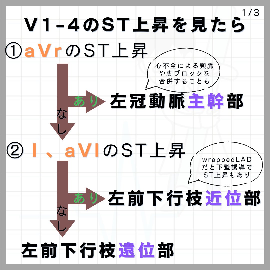 TrRja's tweet photo. いよいよ心電図検定まで後少しです。
質問の多い、心筋梗塞虚血部位とペースメーカについてまとめております。
むしろ「こんなの余裕だぜ」、くらいの息抜きで見てもらえればと思います（笑い）。
続) https://t.co/D9cImSsFkv
