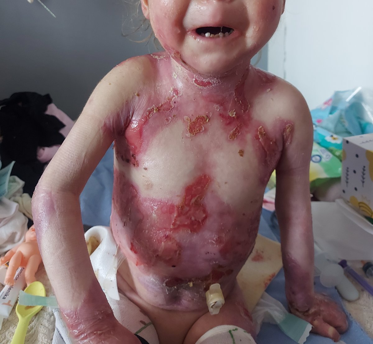 Nađini mesečni troškovi nege su enormni, a hrabri staratelji su joj pružili dom, ljubav i utehu, ali ne mogu sami. Terapija je 650.000$. Uspeli smo za Viktora, možemo opet. Ni jedno dete ne treba da živi ovakve muke.
#zanađu 1519 na 3030!