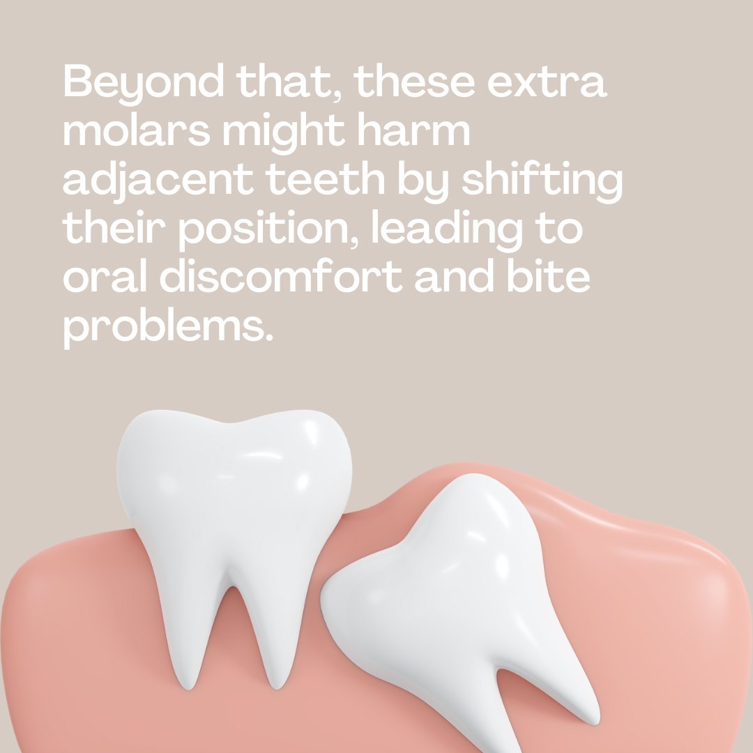 smiles_brite's tweet photo. If your wisdom teeth are causing issues or X-rays indicate potential future problems, it's crucial to consider their removal. These extra molars might harm adjacent teeth by shifting their position, leading to oral discomfort and bite problems. We can help! https://t.co/5cGH3kOoID