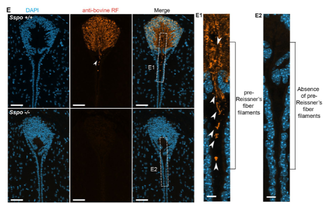 Lehtinen Lab tweet media