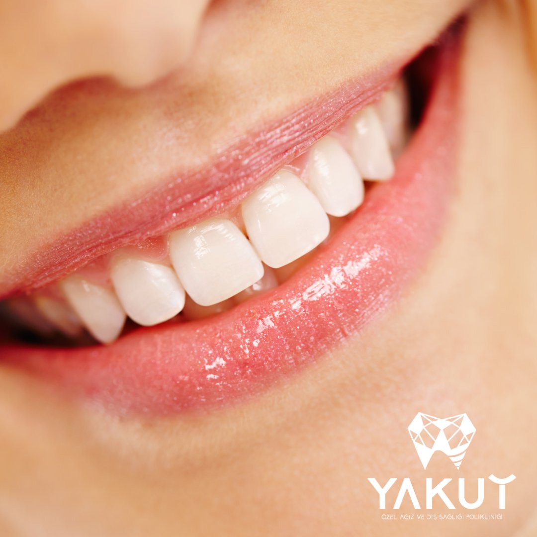 YakutDent's tweet photo. We Care about our patient’s smiles and healthy teeth.
00905527772020
00902125236616
#yakut #implants #yakutdent #DentalImplants #followers #turkey #turkiye #smile #click #diamonds #turizm #healthtourism #health #designer #smiledesigner #healthylifestyle #smiledes
#GTA6 #opay https://t.co/5NKU5TKJH1