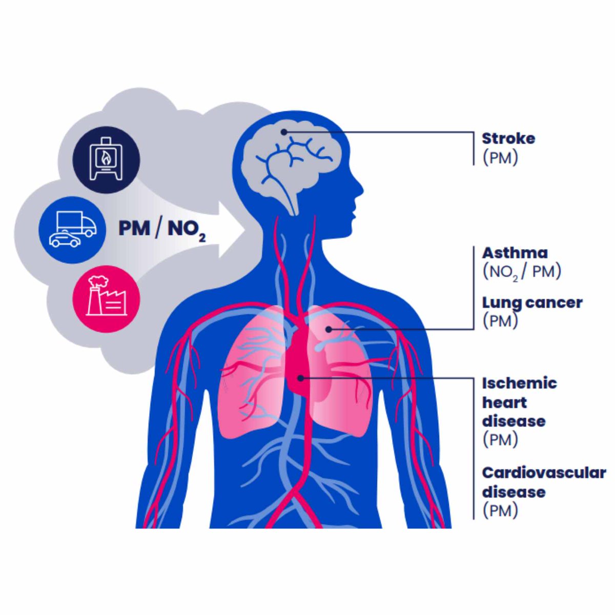 woodburningldn's tweet photo. Our health impact evaluation finds that wood burning costs every Londoner £24 each year and cuts life expectancy by three weeks. https://t.co/f9pUQSY5q5 #lwbp
#woodburning
#woodburninglondon #asthma #stroke #particulatematter https://t.co/3zVazvGWSm