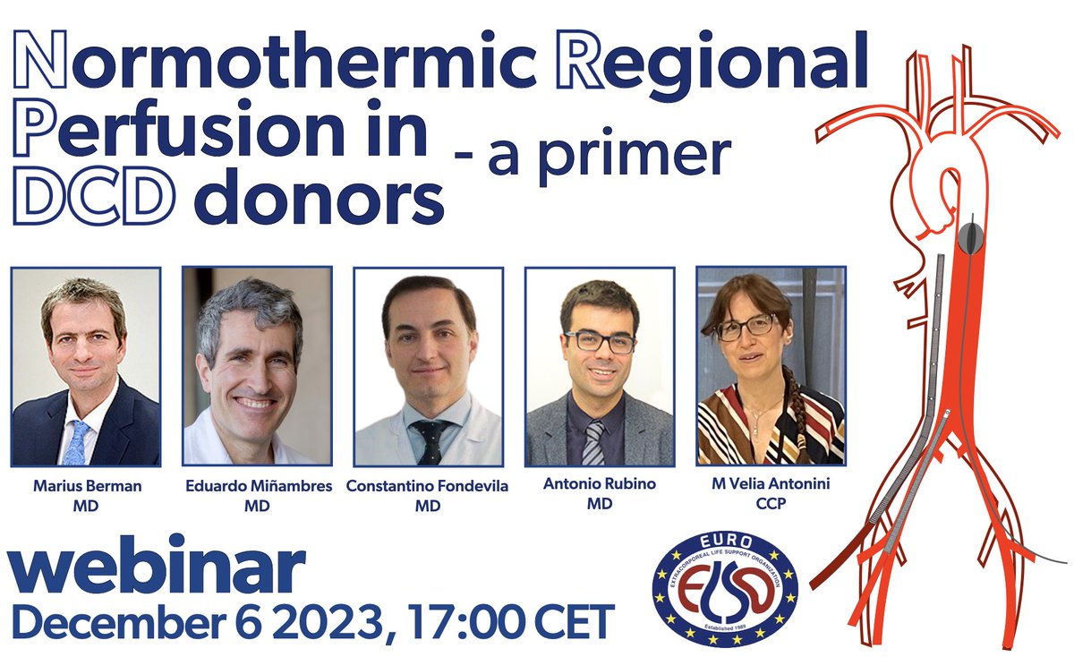 M Velia Antonini (@foamecmo) on Twitter photo ๐ข Normothermic regional perfusion in DCD organ donors <a href="/EuroELSO/">EuroELSO</a> webinar
๐๏ธ Dec 6, 2023 5 pm CET (4 pm UK time)
๐๏ธ Still time to register euroelso.net/webinars/
๐๏ธ moderators <a href="/BermanMarius/">Marius Berman</a> & Eduardo Miรฑambres
๐๏ธ speakers: <a href="/CFondevila/">Constantino Fondevila</a> <a href="/AEA_rubino/">Antonio Rubino</a> <a href="/FOAMecmo/">M Velia Antonini</a>
Webinar is aimed to ๐ข Normothermic regional perfusion in DCD organ donors <a href="/EuroELSO/">EuroELSO</a> webinar
๐๏ธ Dec 6, 2023 5 pm CET (4 pm UK time)
๐๏ธ Still time to register euroelso.net/webinars/
๐๏ธ moderators <a href="/BermanMarius/">Marius Berman</a> & Eduardo Miรฑambres
๐๏ธ speakers: <a href="/CFondevila/">Constantino Fondevila</a> <a href="/AEA_rubino/">Antonio Rubino</a> <a href="/FOAMecmo/">M Velia Antonini</a>
Webinar is aimed to