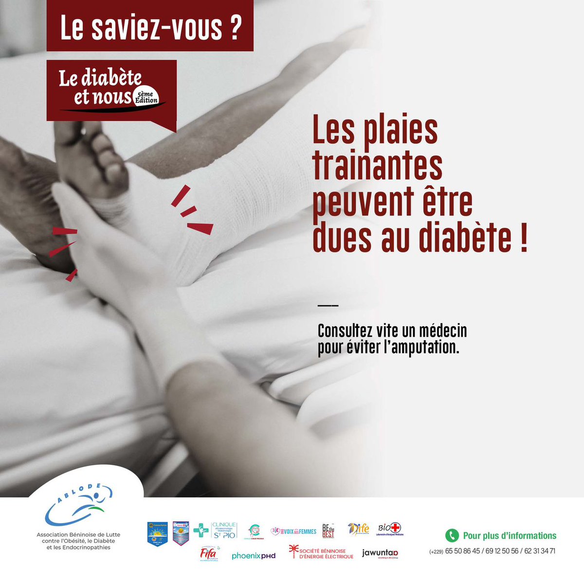 ABLODE_Officiel's tweet photo. Le saviez-vous ?

Les plaies trainantes peuvent être dues au diabète !
Consultez vite un médecin pour éviter l'amputation.

#lediabeteetnous #luttecontrelediabète #santé #wasexo #cotonou #benin #ablodé https://t.co/C8yBFwEykT