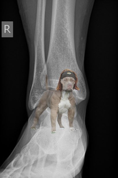 Bruh they said this is Trevor’s X-ray report 💀💀💀💀💀💀