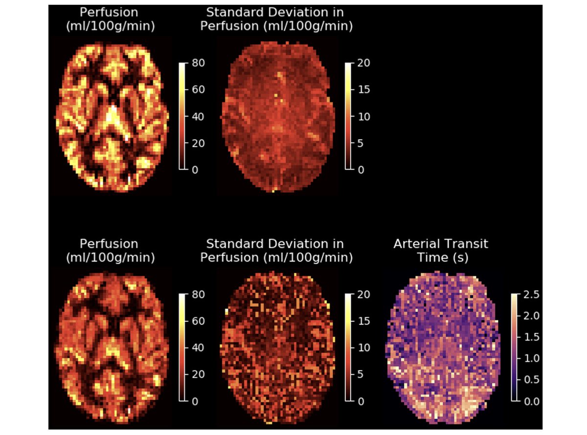 Imaging Neuroscience (@imagingneurosci) on Twitter photo New paper in Imaging Neuroscience <a href="/mitpress/">The MIT Press @mitpress.bsky.social</a> by Michael A. Chappell, Thomas F. Kirk, Thomas W. Okell, Mark W. Woolrich, et al:
BASIL: A toolbox for perfusion quantification using arterial spin labelling
doi.org/10.1162/imag_a… New paper in Imaging Neuroscience <a href="/mitpress/">The MIT Press @mitpress.bsky.social</a> by Michael A. Chappell, Thomas F. Kirk, Thomas W. Okell, Mark W. Woolrich, et al:
BASIL: A toolbox for perfusion quantification using arterial spin labelling
doi.org/10.1162/imag_a…