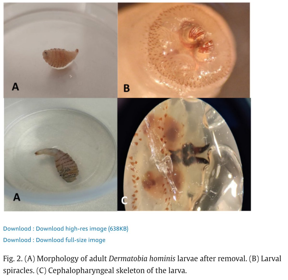 Check out our last publication at TMID with <a href="/natali22med/">Natalia Rodríguez Va</a> <a href="/saviclinicbcn/">SAVI · Atención al Viajero Internacional</a> <a href="/ISGLOBALorg/">ISGlobal</a> : 
"Scalp myiasis presenting as forehead edema in a returning traveller from Belize: A diagnostic challenge"

Amazing figures by <a href="/MiriamJAlvarez/">Miriam ALVAREZ</a> and team!!

sciencedirect.com/science/articl…