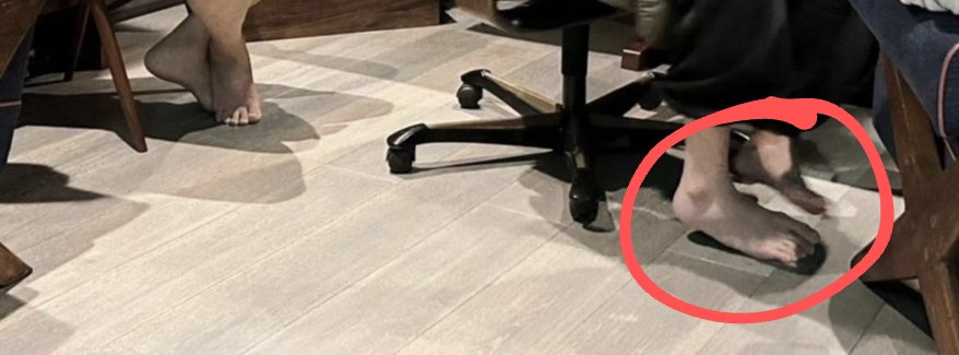 army_noona's tweet photo. What's up with his right foot? 👀 https://t.co/FLQk7pt783