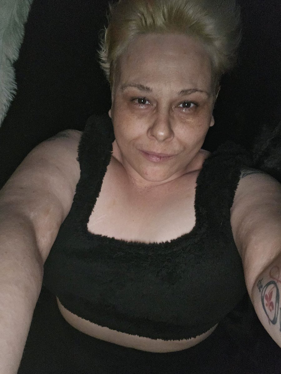 TressenH's tweet photo. God I look old these days.
Chronic pain ages you 💔 https://t.co/IL4feOEOp0
