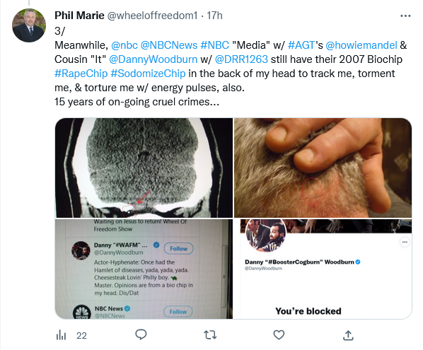 wheeloffreedom1's tweet photo. I will keep fighting back against anyone who feels they have the "right" to torture &amp; injure me w/🛰️⚡️shocks via the biochips in my body...
WHO THE FUCK ARE YOU TO TORTURE ANY HUMAN?
STOP these fucking TERRORISTS! @FBI @DOJCrimDiv @FBIPhiladelphia @FBILosAngeles @FBINewHaven https://t.co/YJISjCAEEv