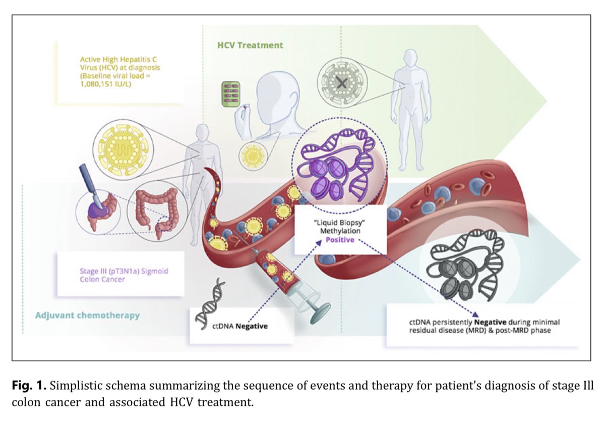 What causes a false➕liquid biopsy?

This is probably the first report of a false➕methylation signal from a very high hepatitis C viremia🦠.

💡As methylation gets used for MRD &amp; early detection, consider non-cancer diseases.

<a href="/OncoAlert/">OncoAlert</a> <a href="/isliquidbiopsy/">International Society of Liquid Biopsy</a> 

karger.com/cro/article/16…