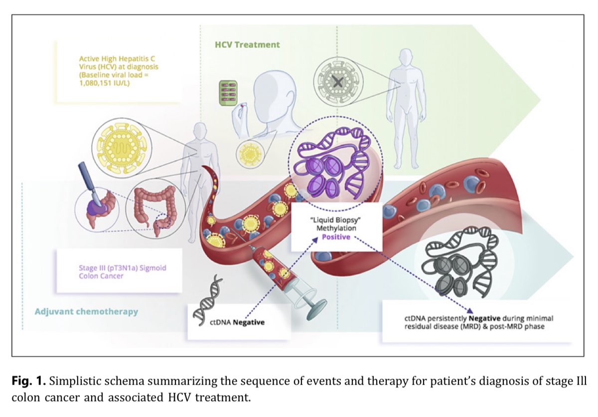 What causes a false➕liquid biopsy? This is probably the first report of a false➕methylation signal from a very high hepatitis C viremia🦠. 💡As methylation gets used for MRD & early detection, consider non-cancer diseases. @OncoAlert @isliquidbiopsy karger.com/cro/article/16…