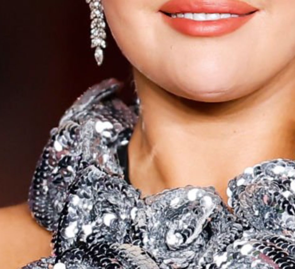 greatestselena's tweet photo. that’s the reflection of her dress which happened in many other pics on her jaw/chin/neck. y’all are dumb https://t.co/gGVGPck4iJ