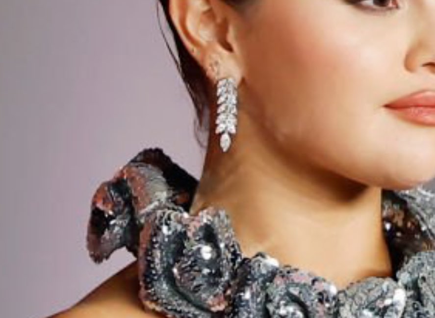 greatestselena's tweet photo. that’s the reflection of her dress which happened in many other pics on her jaw/chin/neck. y’all are dumb https://t.co/gGVGPck4iJ