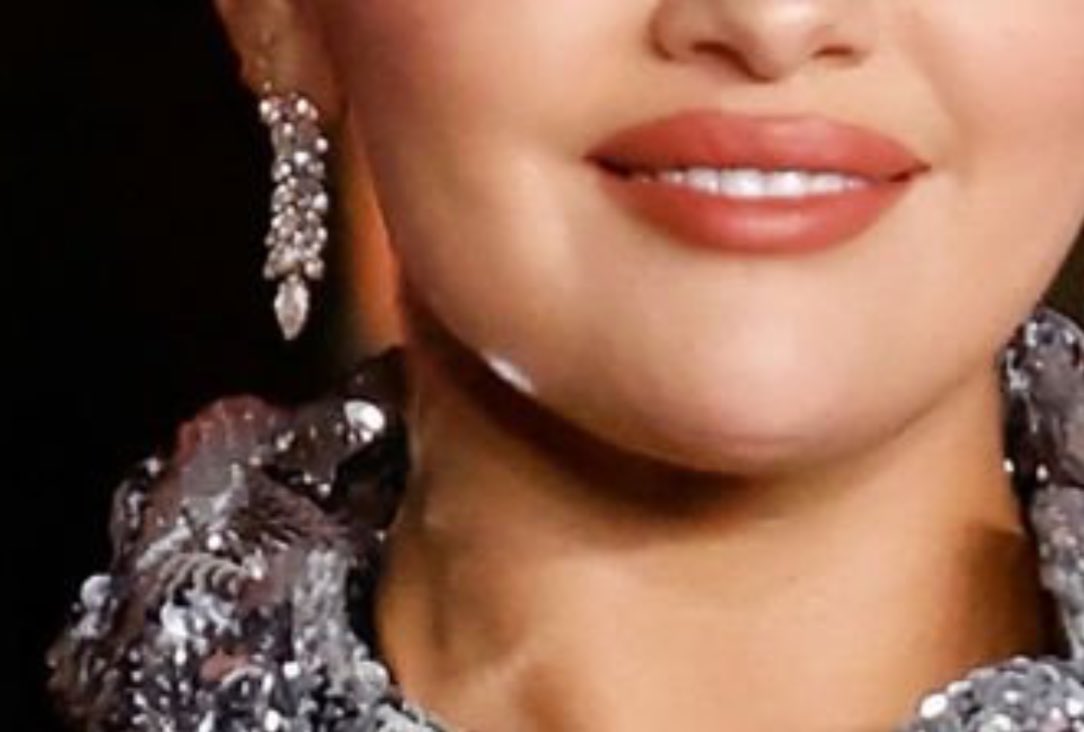 greatestselena's tweet photo. that’s the reflection of her dress which happened in many other pics on her jaw/chin/neck. y’all are dumb https://t.co/gGVGPck4iJ